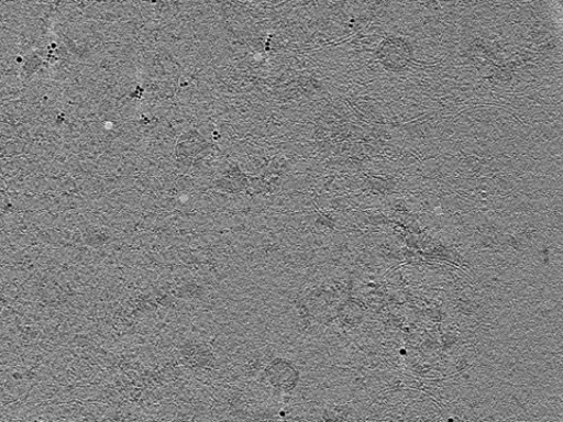 key visualization for CryoET of isolated synaptic vesicles from mouse brain