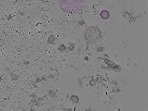 key visualization for tomogram_003
