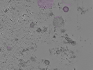 key visualization for tomogram_003