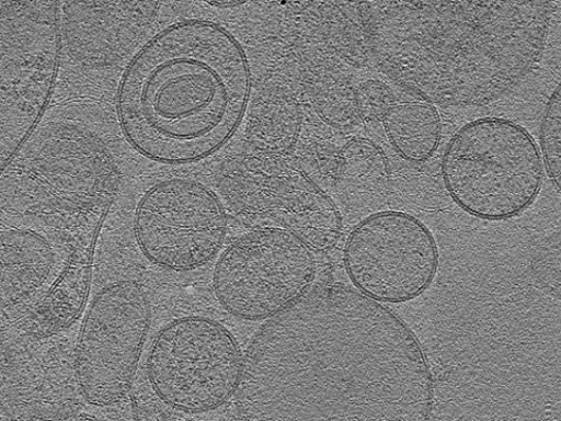 key visualization for tomogram_004