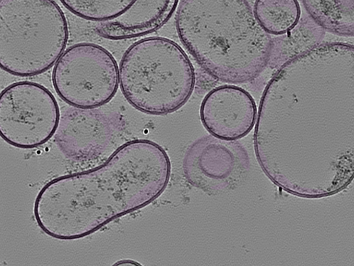 key visualization for tomogram_005