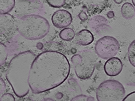 key visualization for tomogram_006