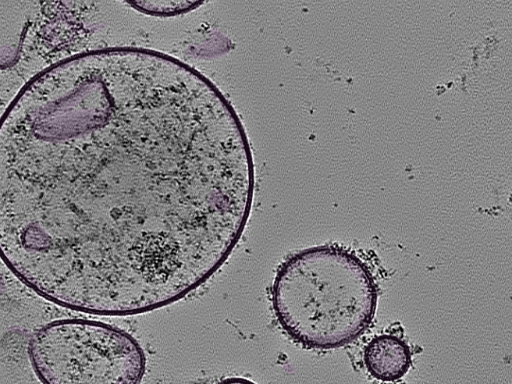 key visualization for tomogram_007