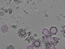 key visualization for tomogram_009