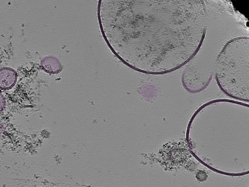 key visualization for tomogram_013