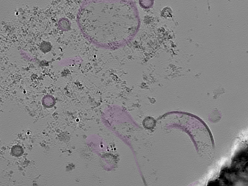 key visualization for tomogram_015