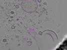 key visualization for tomogram_015