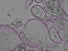 key visualization for tomogram_017