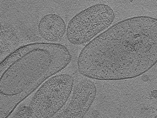 key visualization for tomogram_018