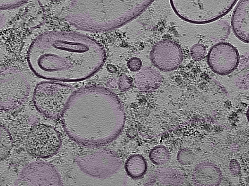 key visualization for tomogram_019