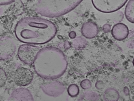 key visualization for tomogram_019
