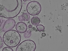key visualization for tomogram_020