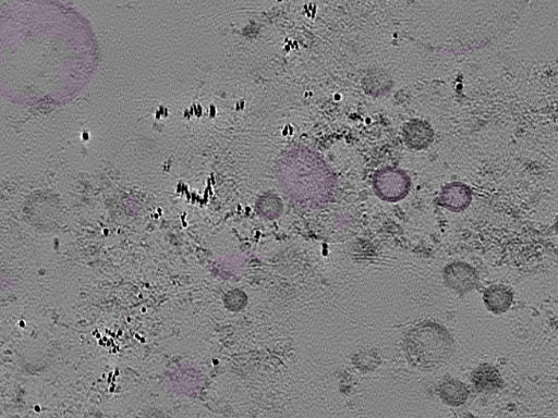 key visualization for tomogram_021