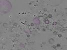 key visualization for tomogram_021