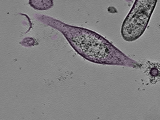 key visualization for tomogram_022