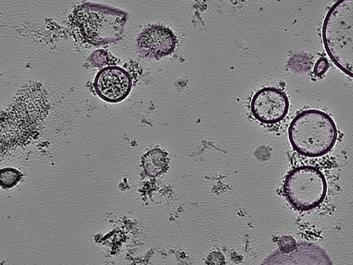 key visualization for tomogram_024