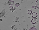 key visualization for tomogram_024