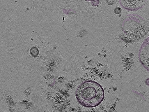 key visualization for tomogram_092