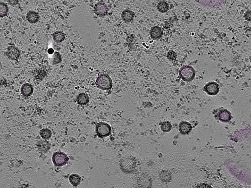 key visualization for tomogram_096