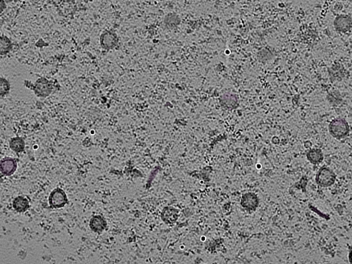 key visualization for tomogram_097