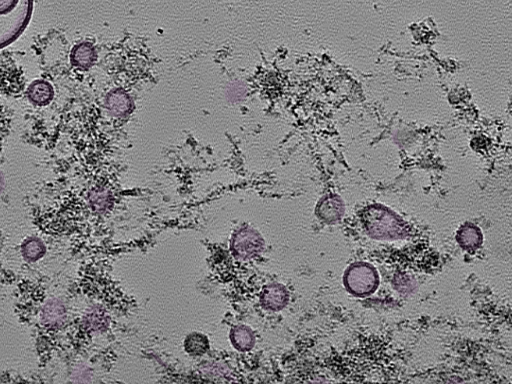 key visualization for tomogram_098