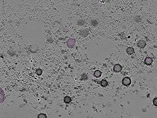 key visualization for tomogram_100