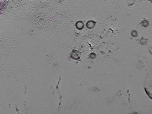 key visualization for tomogram_102