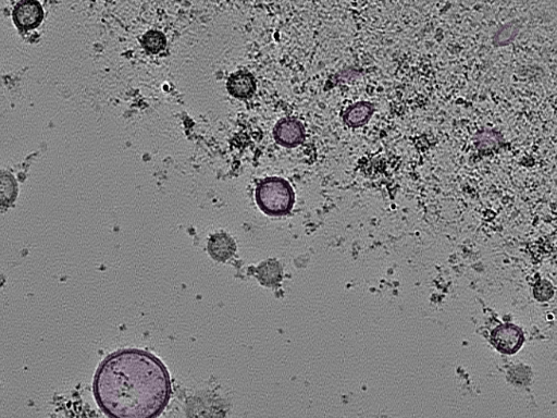 key visualization for tomogram_103
