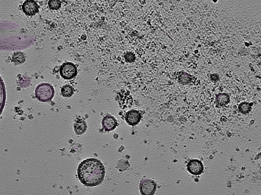 key visualization for tomogram_104