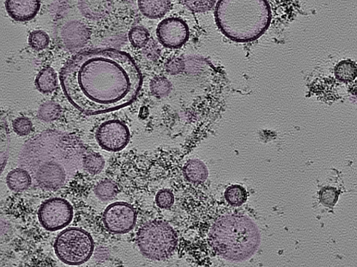 key visualization for tomogram_105