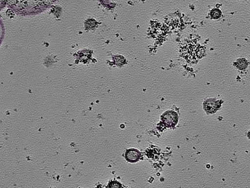 key visualization for tomogram_107