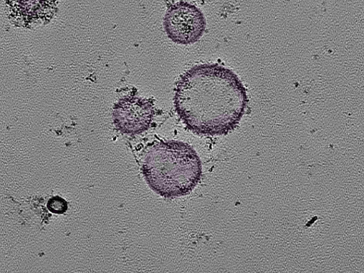 key visualization for tomogram_108