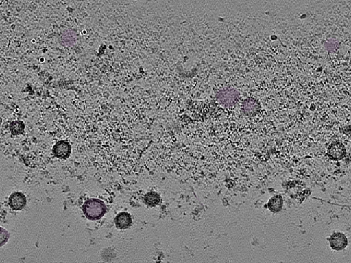 key visualization for tomogram_109