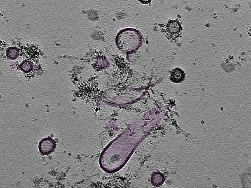 key visualization for tomogram_110