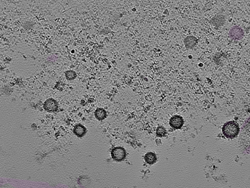 key visualization for tomogram_111