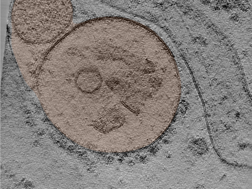 key visualization for Large-scale cryo-ET dataset of affinity-captured organelles (LAMP1 + SpyCatcher 10nm Gold) HEK293T cells