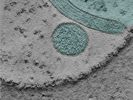 key visualization for Large-scale cryo-ET dataset of affinity-captured organelles (TMEM192 + Starvation + V1A SidK-Gold) HEK293T cells