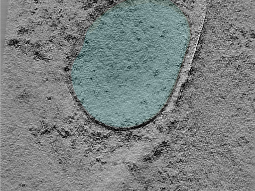 key visualization for Large-scale cryo-ET dataset of affinity-captured organelles (TMEM192 + Bafilomycin + V1A SpyCatcher-Gold) HEK293T cells