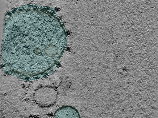 key visualization for Large-scale cryo-ET dataset of affinity-captured organelles (TMEM192 + Bafilomycin + mLST8 SpyCatcher-Gold) HEK293T cells
