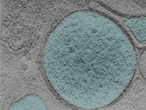 key visualization for Large-scale cryo-ET dataset of affinity-captured organelles (TMEM192 + Starvation/Stimulation + Dual Labeling) HEK293T cells