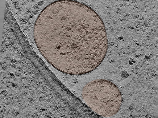 key visualization for Large-scale cryo-ET dataset of affinity-captured organelles (TMEM192 + Starvation + Negative Control) HEK293T cells