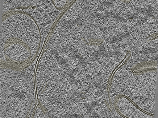key visualization for Cryo-electron tomography of G-TPP-treated HeLa cells under mitochondrial proteostatic stress
