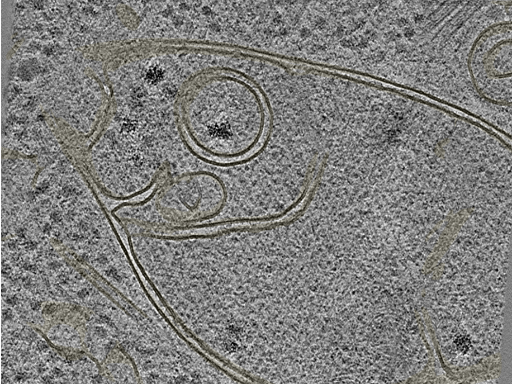 key visualization for Cryo-electron tomography of untreated HeLa cells (control)