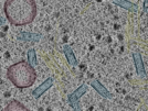 key visualization for CryoETSim general subset - simulated cryo-electron tomograms of cellular molecular crowding