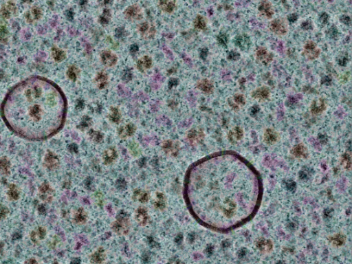 key visualization for sample_306