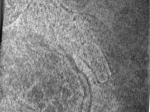 key visualization for Cryo-ET of purified Rickettsia parkeri ompBSTOP::tn bacteria (1.9 A, UW-Madison K3)