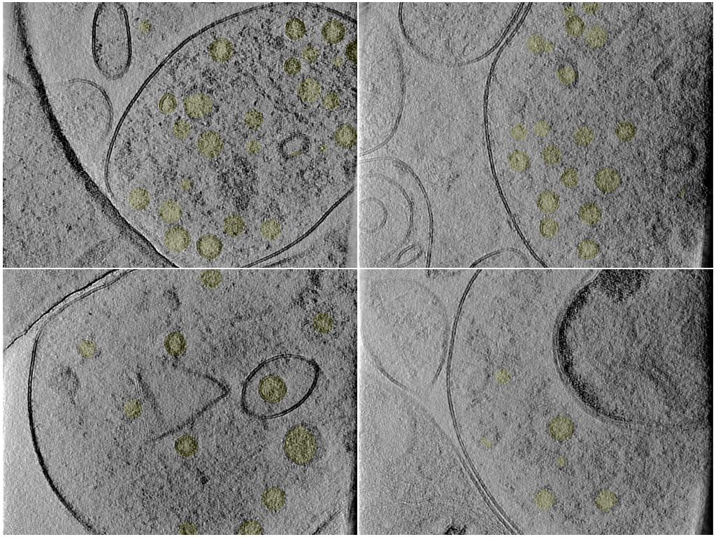 key visualization for Automated Synaptic Vesicle Segmentation in Synaptosomes