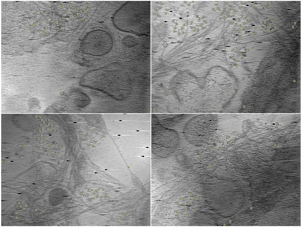 key visualization for Training annotations and octopi predictions of ribosomes in unroofed human cells