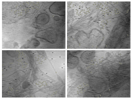 key visualization for Training annotations and octopi predictions of ribosomes in unroofed human cells