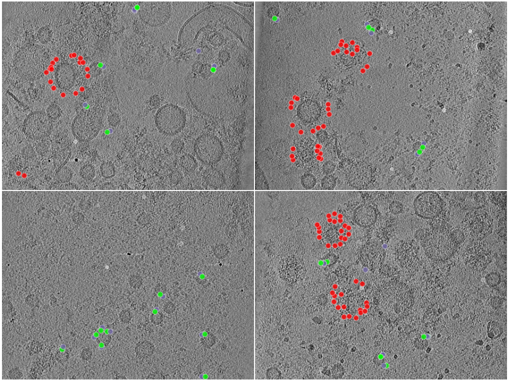 key visualization for CryoET of isolated synaptic vesicles from mouse brain